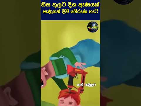 හිස පසාරු කරගෙන යකඩ ඇණයක් ගියත් බේරුණ මිනිසෙක් 😮 #shorts #sathsamudura