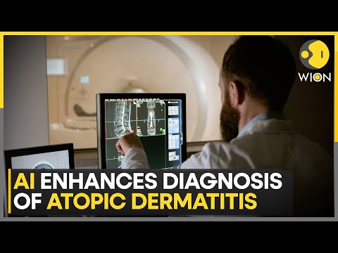 AI Boosts Accuracy Of Skin-Related Diagnosis | World News | WION