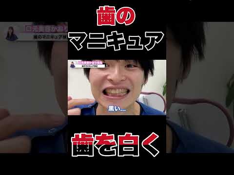 歯のマニキュアでホワイトニング効果?