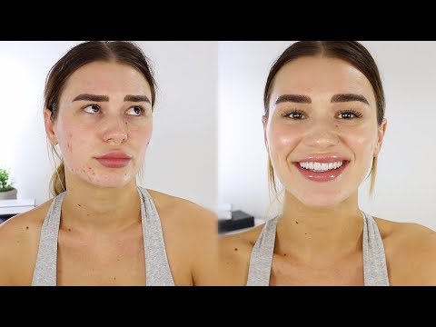 5 MIN EVERYDAY MAKEUP TUTORIAL // HIDING MY ACNE - UCPG6A5tNaPfv2SRNW2beq5Q