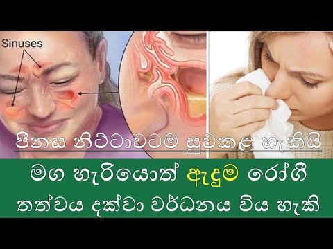 පීනසය සුළුවෙන් තකන්න එපා| පීනසට රෝග ලක්ෂණ බලපාන හේතු ප්රතිකාර |Catarrh Symptoms causes treatment