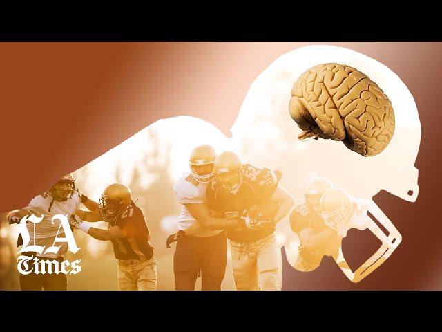 What Is CTE in NFL Players?
