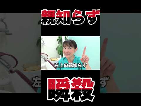 上の親知らずは一瞬です。瞬き厳禁!