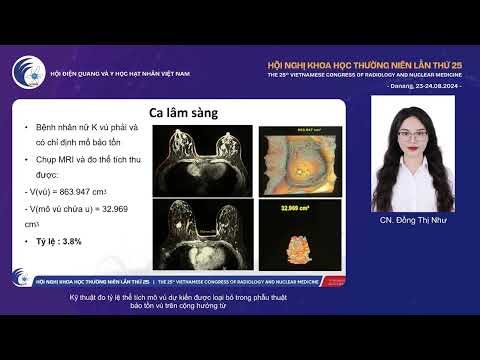 4. Kỹ thuật đo tỷ lệ thể tích mô vú dự kiến được loại bỏ trên cộng hưởng từ (CN. Đồng Thị Như)