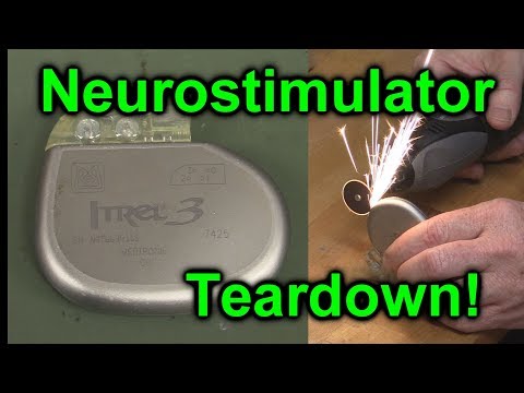 EEVblog #1027 -  Implantable NeuroStimulator Teardown - UC2DjFE7Xf11URZqWBigcVOQ