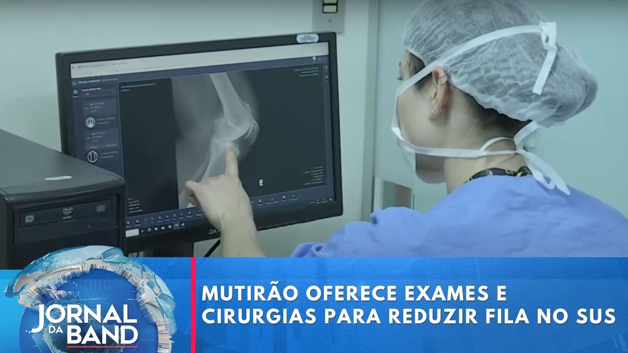 Mutirão oferece consultas, exames e cirurgias para reduzir fila no SUS | Jornal da Band