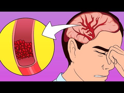 A Scientific Way to Cure a Headache Without Painkillers - UC4rlAVgAK0SGk-yTfe48Qpw