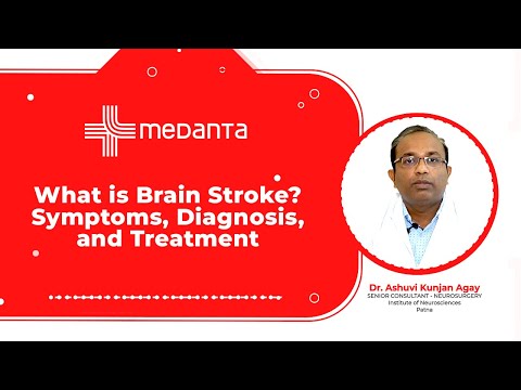 What is Brain Stroke? Symptoms, Diagnosis, and Treatment | Dr. Ashuvi Kunjan Agay | Medanta Patna