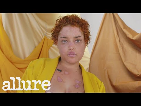 How This Lupus Advocate Finds Beauty in Illness | Allure