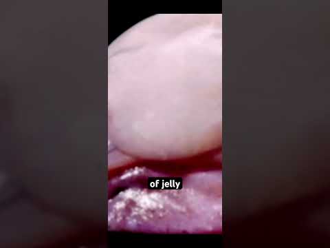 The Blobfish #weirdanimals #top5animals #strangecreatures #wildlife #wildlifefacts