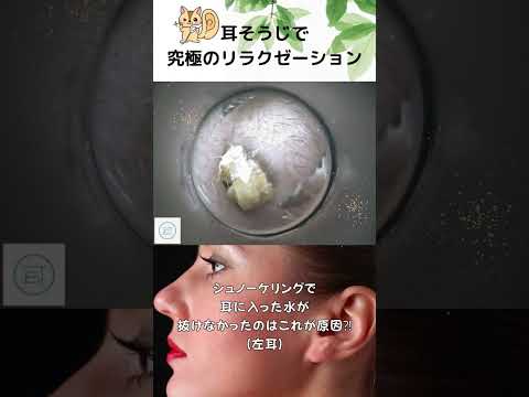 【左耳】シュノーケリングで耳に入った水が抜けなかったのはこれが原因⁈