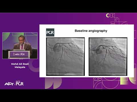 A hybrid approach in complex PCI: can DES and DCB be complementary? – AICT-AsiaPCR 2023