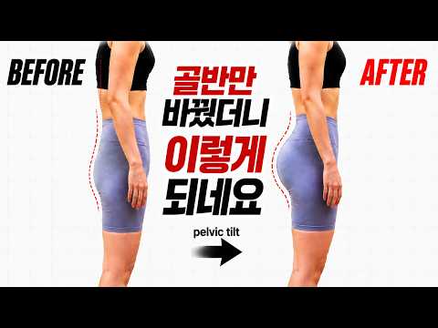 골반만 바꿨더니 엉덩이 근육이 생겨버렸어요 | 골반 후방경사 교정