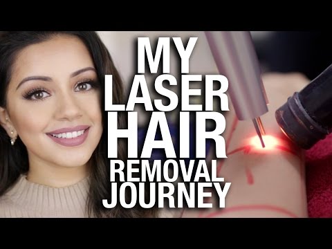 My Laser Hair Removal Journey