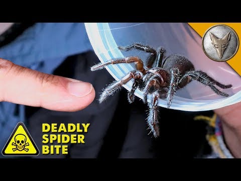 DEADLIEST SPIDER BITE! - UC6E2mP01ZLH_kbAyeazCNdg