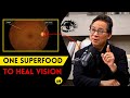 1 SUPERFOOD  That can HEAL your VISION Loss  Dr. William Li