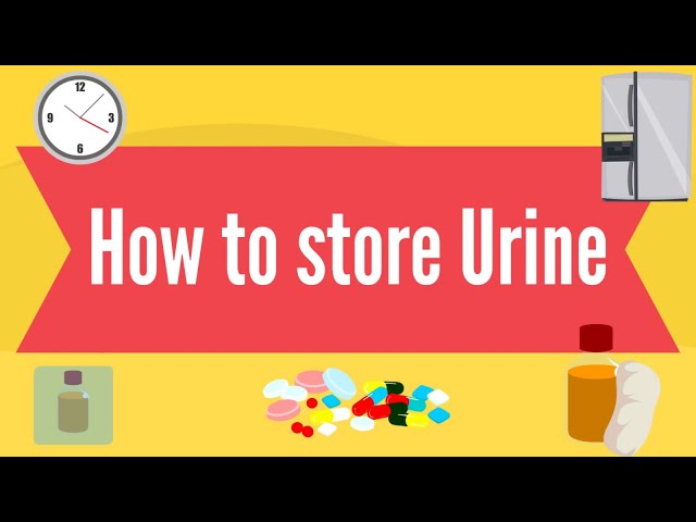 How to Preserve a Urine Sample