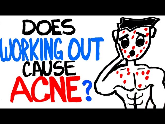 does-working-out-help-acne-workout-daily