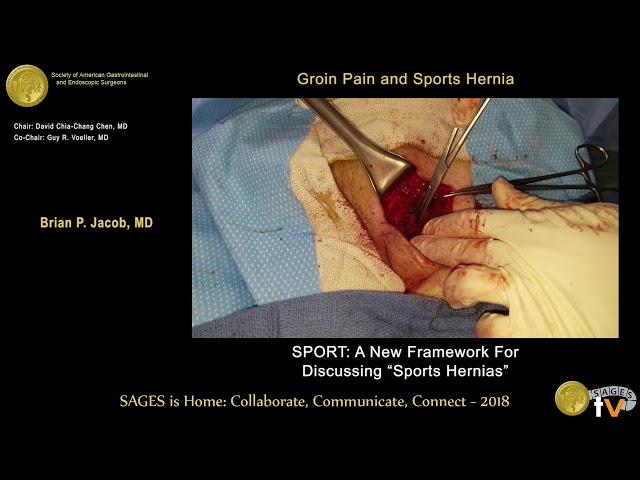 What Is Sports Hernia Surgery and How Can It Help You?