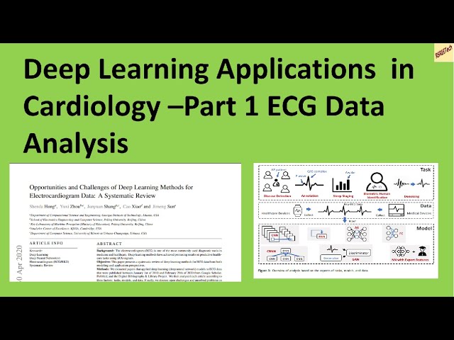 How Deep Learning is Changing ECG Analysis