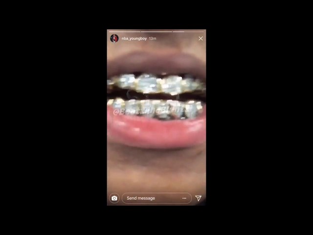 NBA Youngboy and His Grill