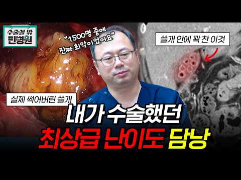명치, 윗배 통증 방치하면 100% 이렇게 됩..