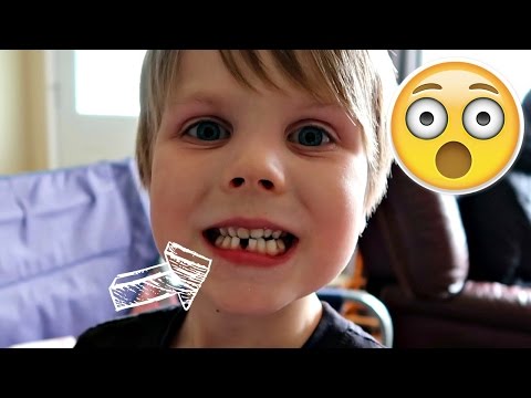 GOT A TOOTH KNOCKED OUT! - UC7HyvAyzpbtlw8nZ8a4oN1g