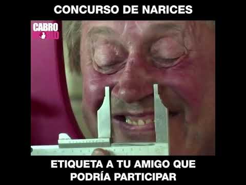 CONCURSO DE NARICES 