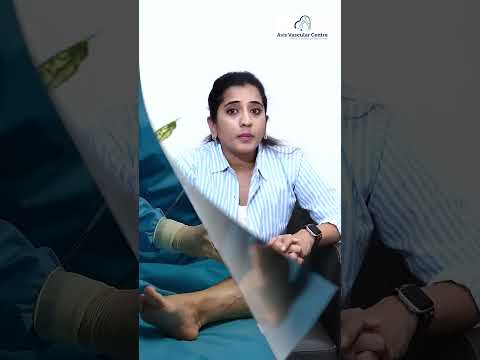 Did You Know_ 1 in 3 Has Varicose Veins | Avis Vascular Centre | Promotional AD  | TV5 News