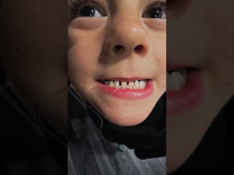 Liamov prvi zobek ❤️