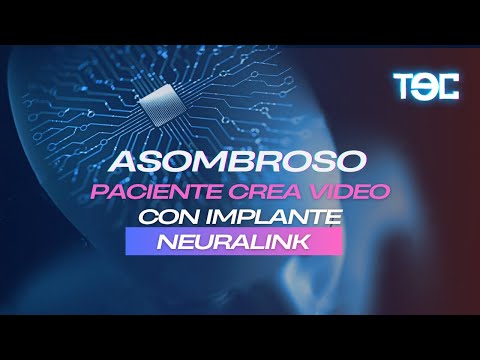 ASOMBROSO: PACIENTE CON ELA CREA VIDEO CON IMPLANTE NEURALINK