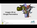 Imagen de la portada del video;Imagen 3D en Cirugía Pancreática