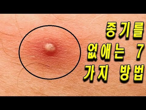 종기를 없애는 7가지 방법|[HealthTips]