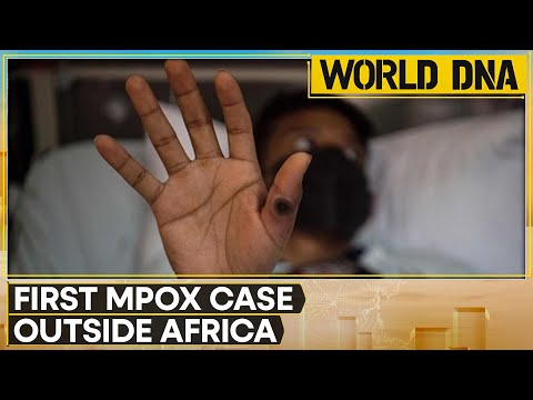 Sweden confirms first case of Mpox virus outside Africa | WION World DNA