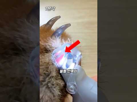 쫄지 않고 발톱을 깎는 도구