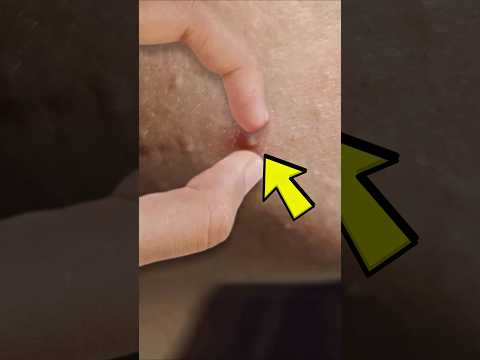 SCHIACCIALO e le conseguenze NON TI PIACERANNO! 😨 - Edonikko