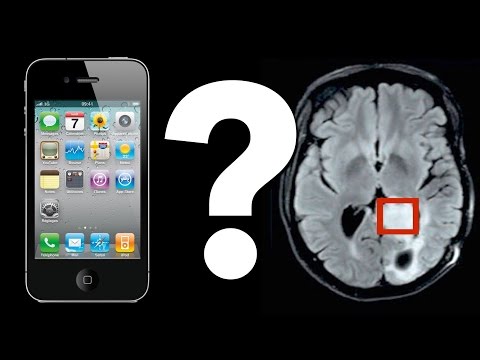 Do Cell Phones Cause Brain Tumors? - UCHnyfMqiRRG1u-2MsSQLbXA