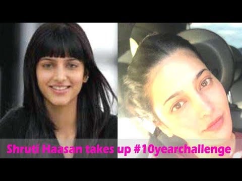 Video - Shruti Haasan takes up #10yearchallenge, gets trolled for going under the knife