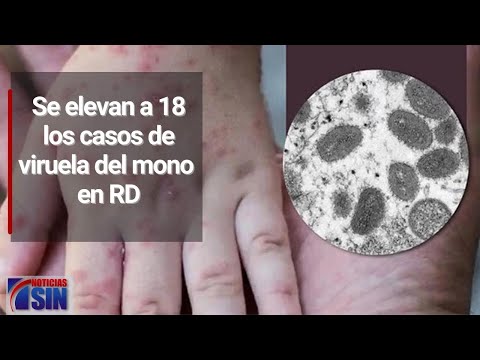 #PrimeraEmisión: Casos dengue y exigen arreglo