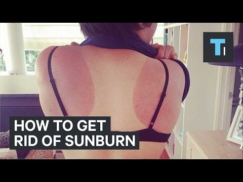 How to get rid of sunburn - UCVLZmDKeT-mV4H3ToYXIFYg