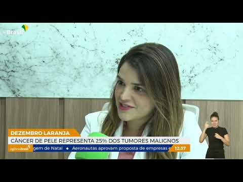 Câncer de pele representa 25% dos tumores malignos
