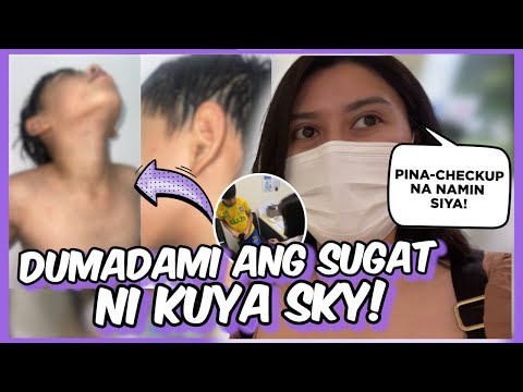 NAGKASUGAT ANG BUONG KATAWAN NI SKY (Pinacheck up na namin sa Doktor) 💜 Nanay Isha