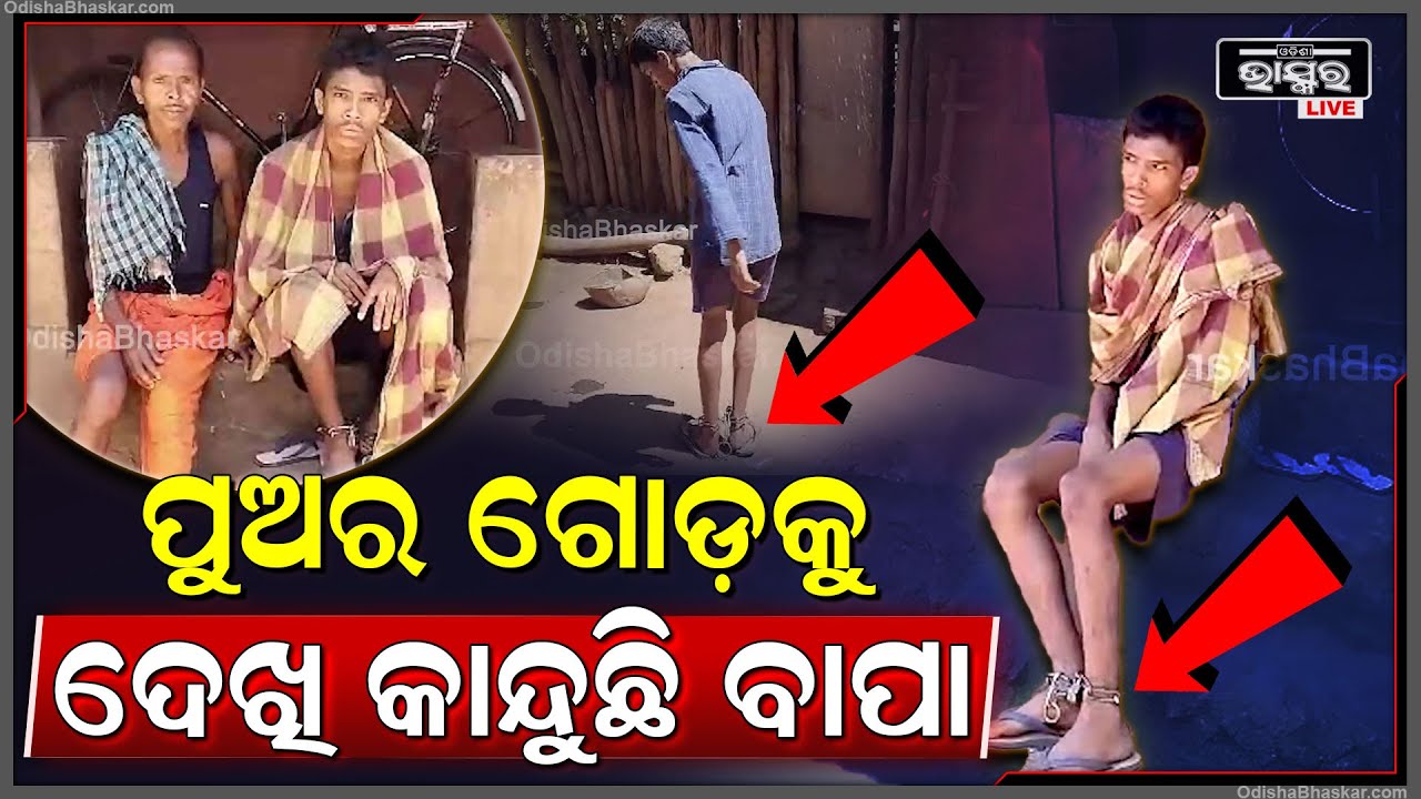 ଶିକୁଳିରେ ବନ୍ଧା ପୁଅର ଜୀବନ, ପୁଅର ଏଇ ଅବସ୍ଥା ଦେଖି ଚିନ୍ତାରେ ବାପା ଆଉ ପୁଅ କହୁଛି...