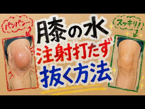 膝の水を注射打たずスッキリ抜く!座りながら簡単にできる膝の水抜き法3選