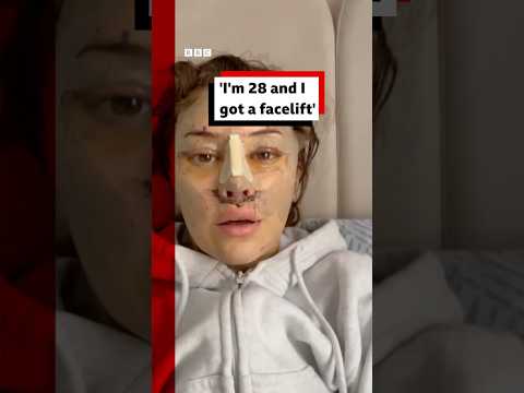 "I'm 28 and I got a facelift". #Facelift #PlasticSurgery #BBCNews