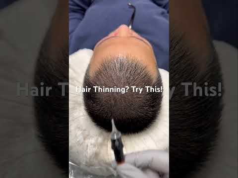 Scalp Micropigmentation CA #ScalpMicropigmentation #scalpmicropigmentationtraining #smp #smptraining