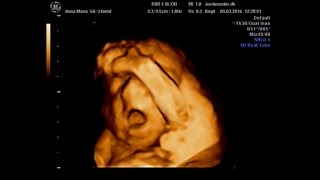 USG - 3D/4D Scanning - 24 tydzień ciąży