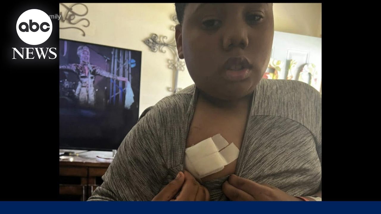 11-year-old shot by police officer after calling 911 speaks from Mississippi home | WNT