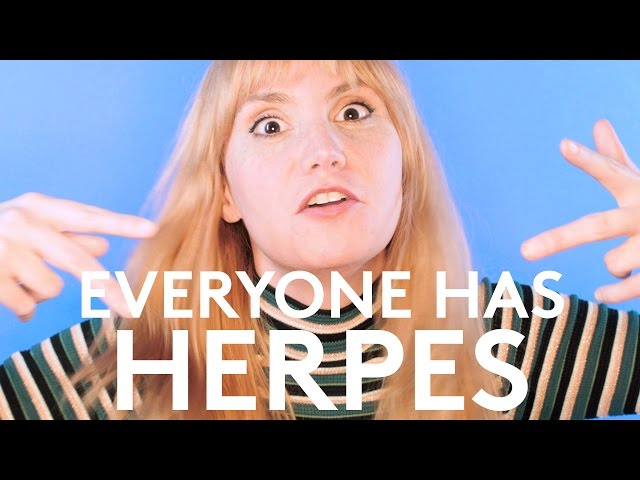 where-does-herpes-live-to-get-ideas