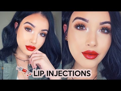 My Lip Injection Experience + Q&A - UCEZtkE45zjun9zROKtcqOcQ